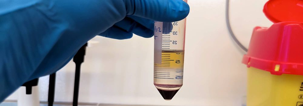 Le CRB du CHU de Nîmes est labellisé IBiSA