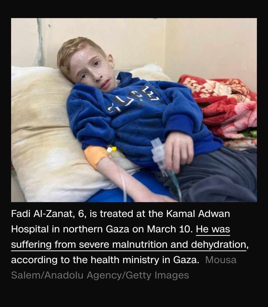 10 year old boy in Gaza hospital suffering severe malnutrituon.