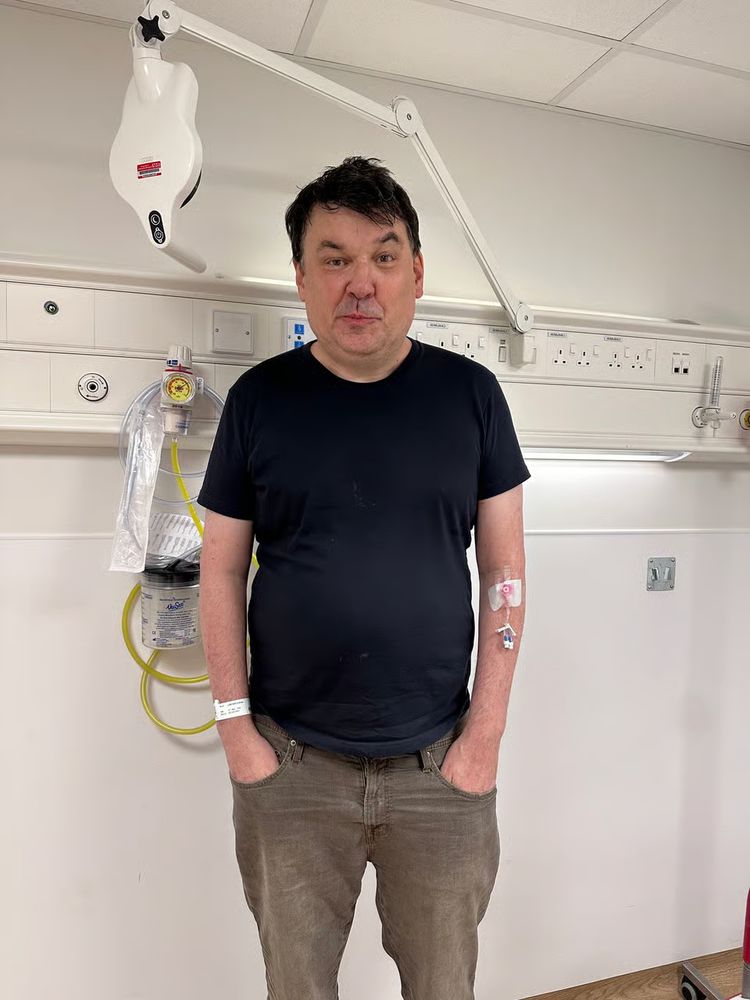 Graham Linehan standing with his hands in his pockets and an IV in his arm. He has his eyebrow raised and his mouth and nose scrunched off to the side but it's less 