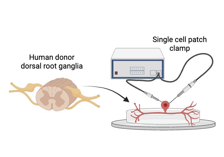 An image of human dorsal root ganglia being used in patch clamp experiments.