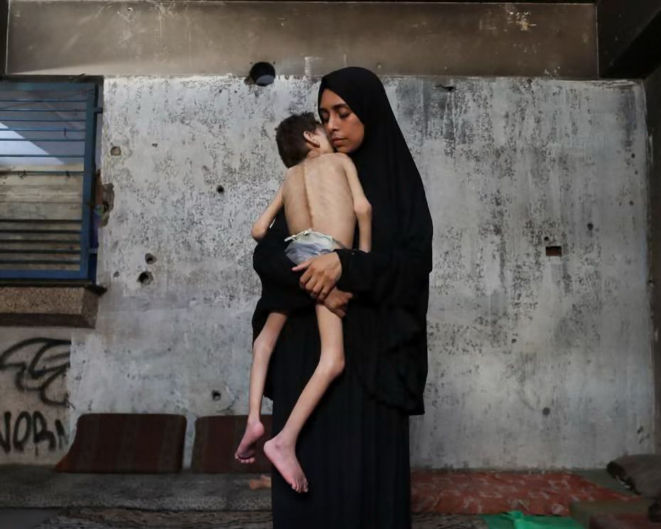 A photograph of a Palestinian mother in Gaza, holding her severely malnourished child