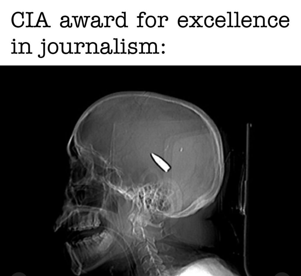 X-ray of skull with rifle bullet inside it.