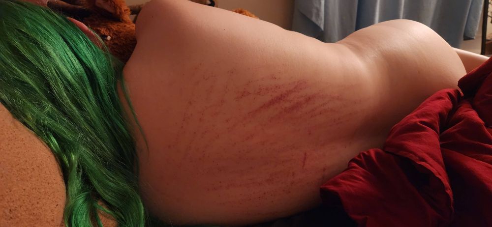 its laying on its side with its back facing the camera, the scratches its Owner made on its back are visible, red and angry.