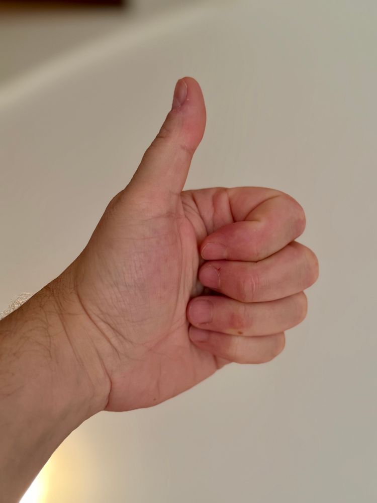 Foto meiner linken Hand mit gestrecktem Daumen
