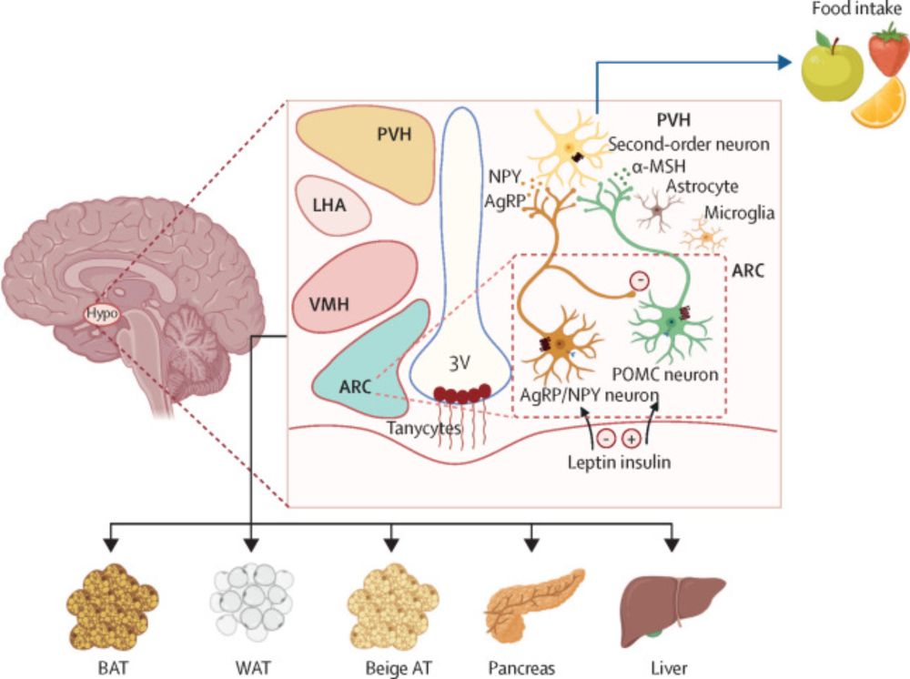 Hypothalamic obesity: from basic mechanisms to clinical perspectives