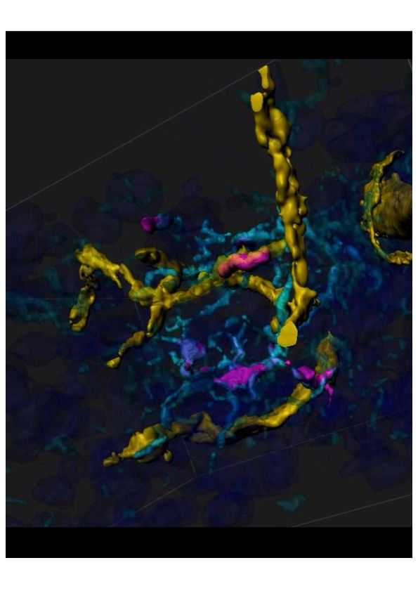 monocytes and monocyte-derived microglia in the mouse brain