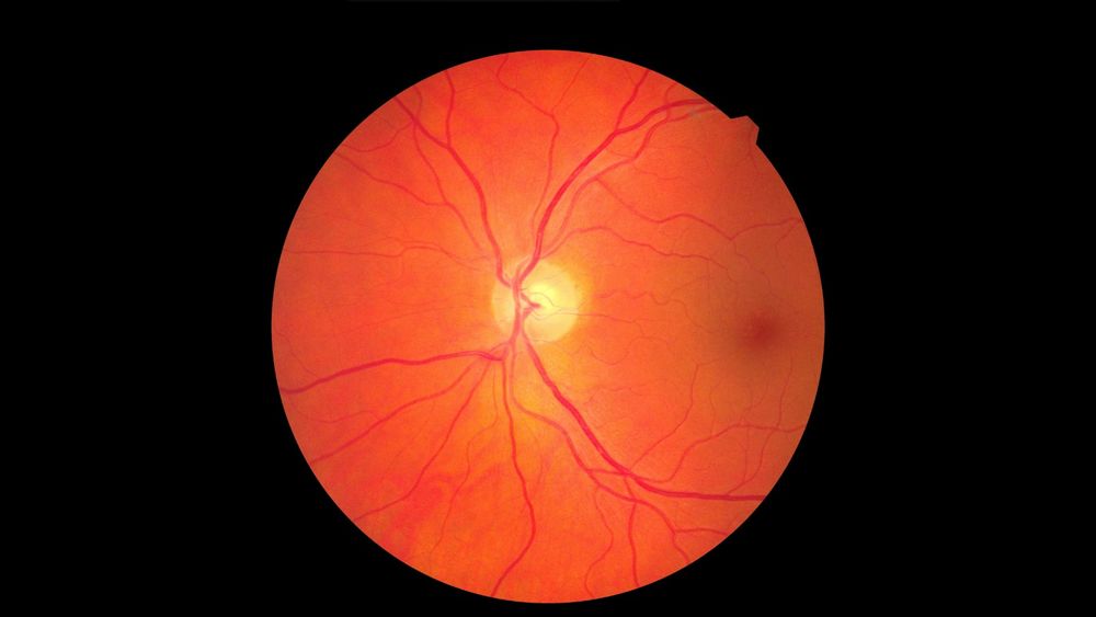 Retinal scan