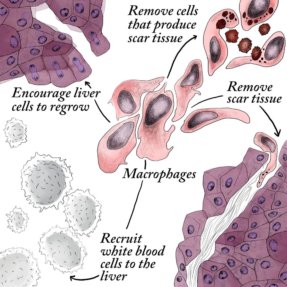 A scientific diagram showing the impacts of macrophage treatment in the liver. Macrophages remove scar tissue, recruit white blood cells to the liver, and encourage regrowth of healthy tissue.
