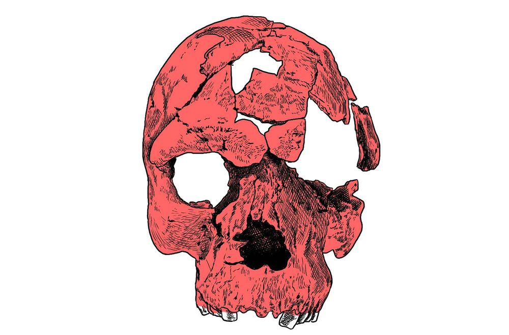 Line drawing of a fragmented skull seen from the front