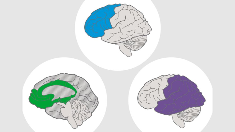 The UDL Guidelines