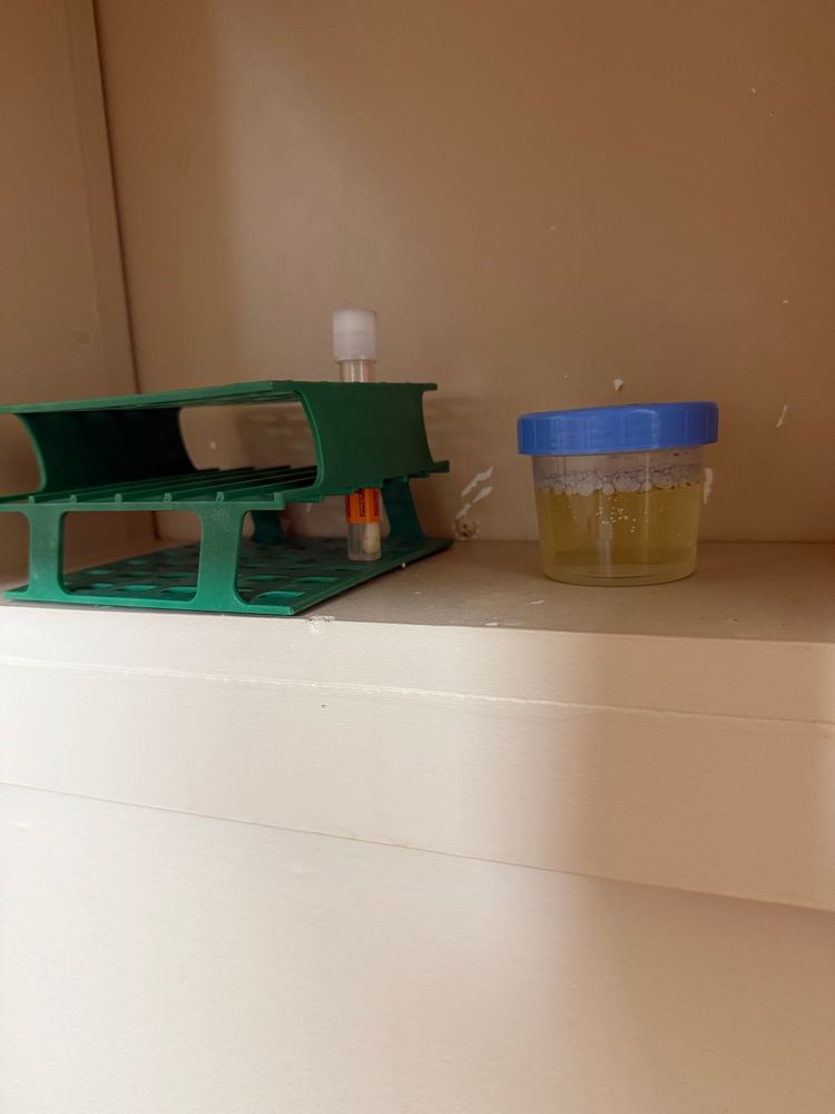 A cabinet with a small, clear cup and a green tray. The cup is full of pale yellow liquid and has a light blue lid. The green tray has a tube in it with a white lid and orange label.
