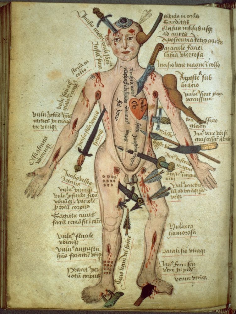 An illustration of a naked man. He is being hit or pierced with various weapons including knives, swords, and clubs. Next to the wounds is text describing accompany treatments. This illustration is from the Wellcome Collection in London.