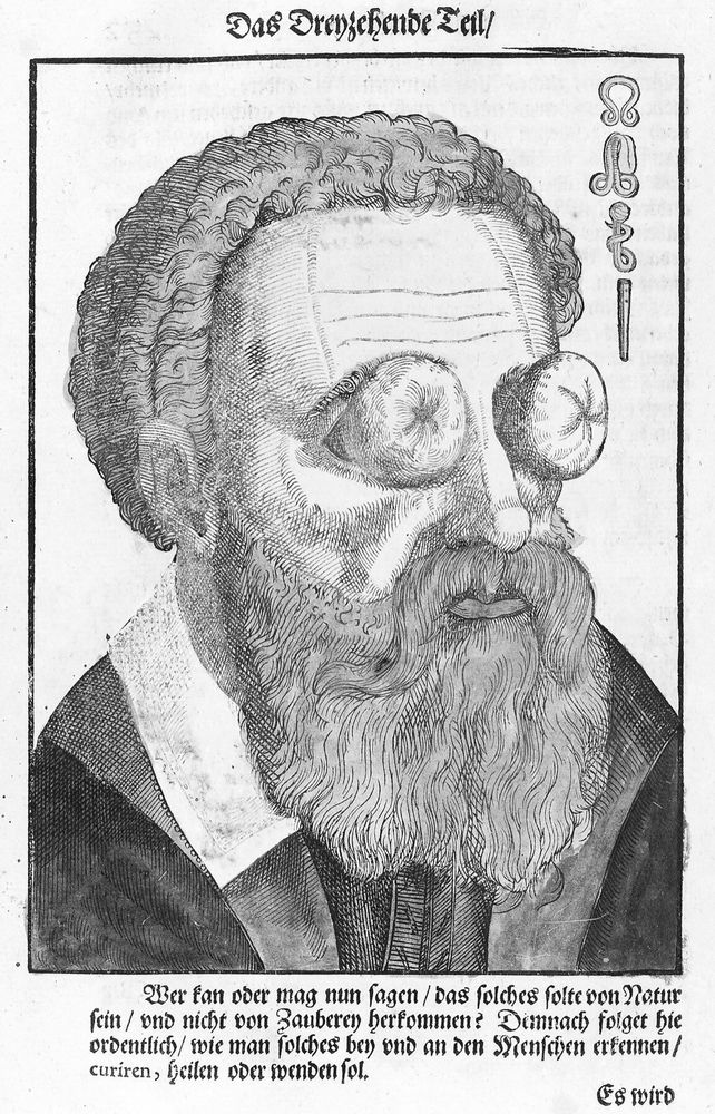 A black and white illustration of a man with short curly hair and a long beard. Where his eyes are meant to be, it looks like there are two bulging tomatoes.