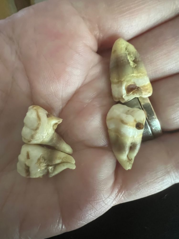 Teeth. My teeth. My gross as fuck wisdom teeth I lived with for many years because we couldn't afford the surgery to remove them.

I had double rows of teeth so they impacted because my jaw is small.

My teeth are lonely. They need friends.