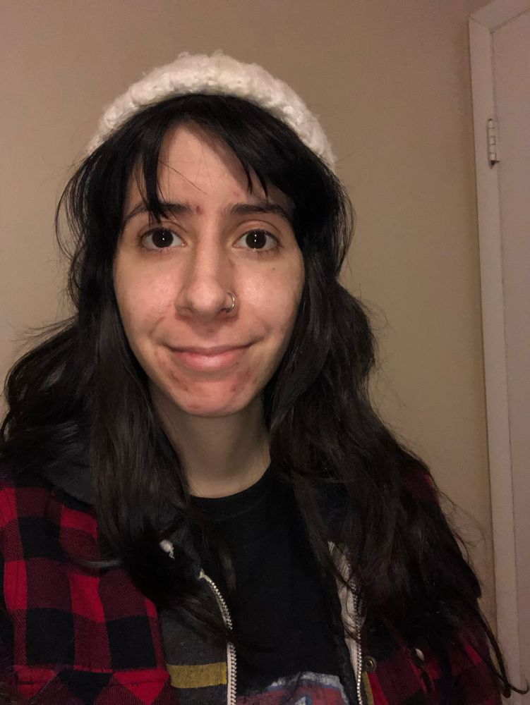 Jason, a few hours before starting testosterone