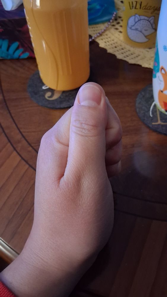 Bild 2: Mein Daumen liegt auf meiner Faust. 