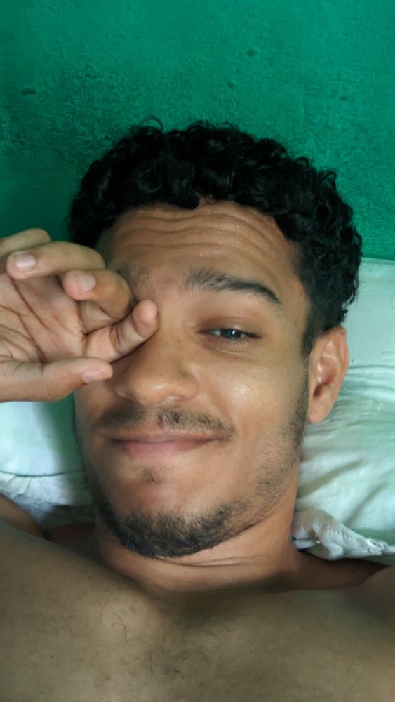 Homem pardo com cabelos cacheados pretos e barba por fazer, olhos castanhos, com a mão esquerda sobre o olho esquerdo.