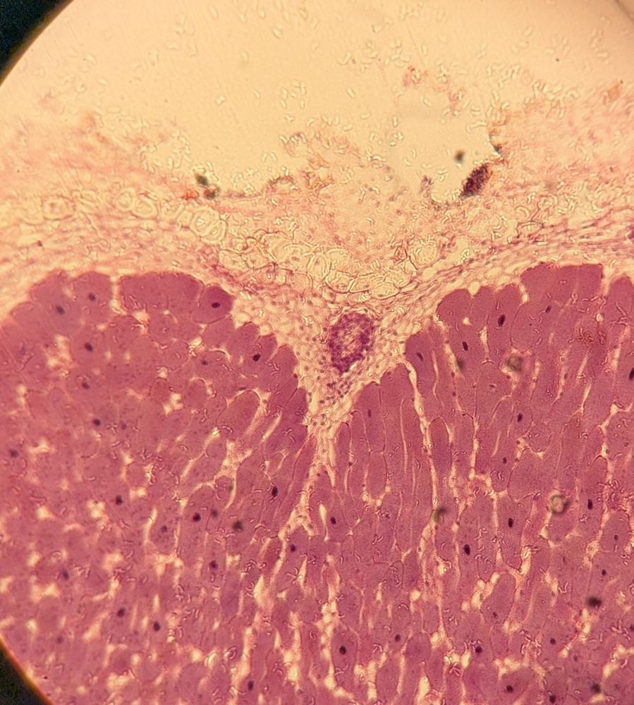 Fotografía de un corte de nódulo en raíz de leguminosa mostrando células vegetales y bacterias viviendo en simbiosis.
