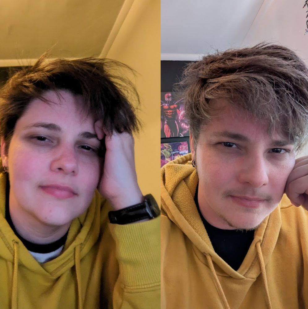 two images of a white transmasc person in a yellow hoodie, taken 2 years apart