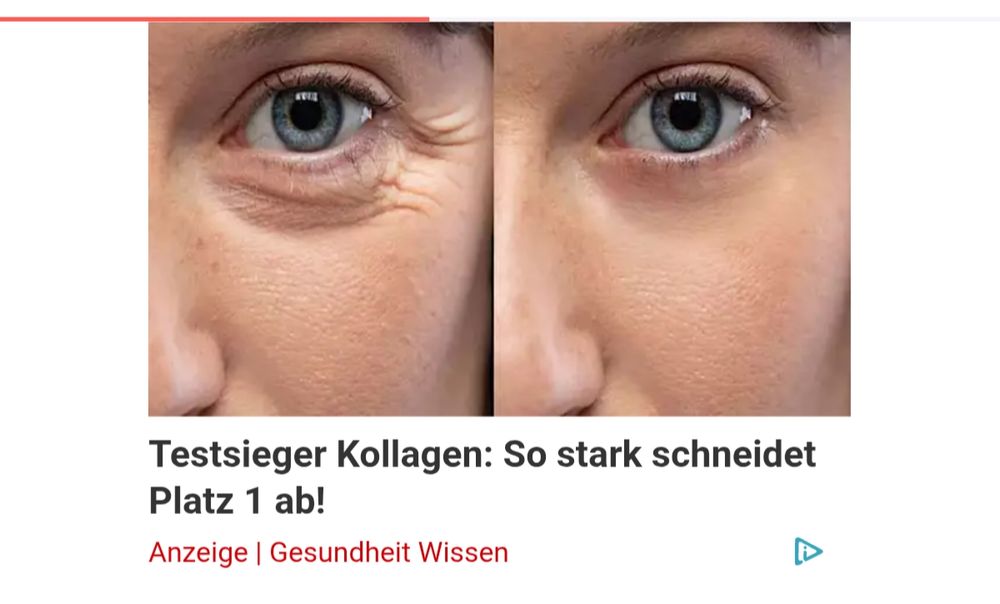 Zweimal das gleiche Foto einer Gesichtshälfte, einmal mit Falten und einmal ohne. Darunter der Text: "Testsieger Kollagen: so stark schneidet Platz 1 ab!"
