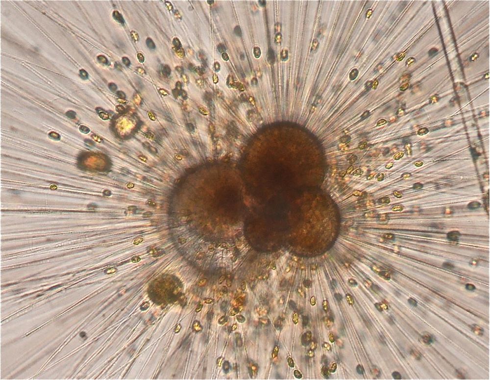 Here is a foraminiferan (or "foram"), a kind of Rhizarian amoeba that lives in a house it builds out of calcite, or sometimes glued together sand & detritus. Its arms are very thin and full of microtubules. Photo by Bärbel Hönisch