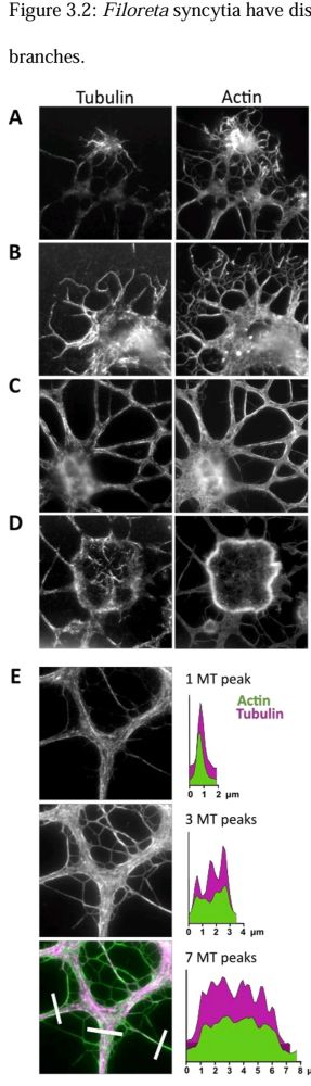 Microtubules / Actin in the Rhizarian amoeba Filoreta ramosa. Graphic by Sarah Guest, from https://escholarship.org/uc/item/7qz2x9ts