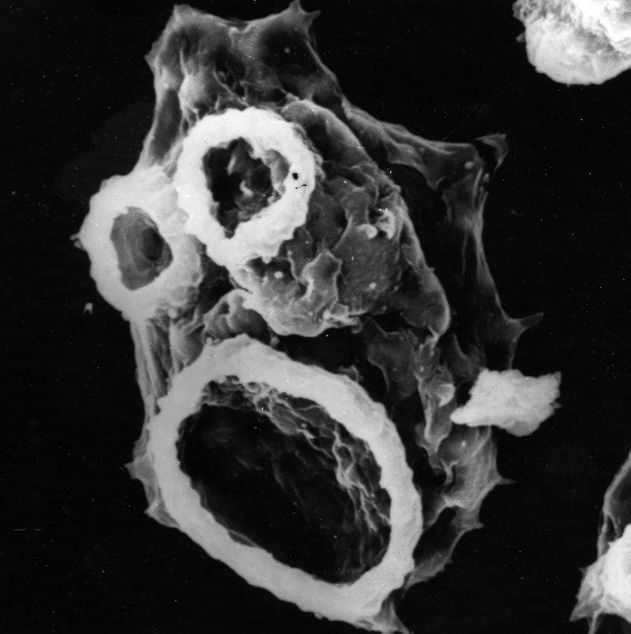 Here is a Discoban amoeba named Naegleria fowleri. The part that looks like a mouth is a mouth. The parts that look like eyes are also mouths. This amoeba sometimes eats human brains. Photo by Francine Marciano-Cabral