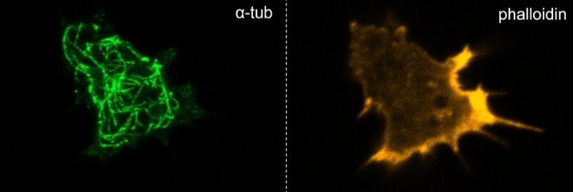 Microtubules / Actin in the Amoebozoan amoeba Idionectes vortex. Graphic by Sebastian Hess, from https://doi.org/10.1111/jeu.12869