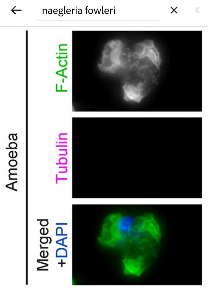 Actin / Microtubules (none) of the Discoban amoeba Naegleria fowleri. Graphic by Velle & Fritz-Laylin, from https://doi.org/10.1083/jcb.202007158