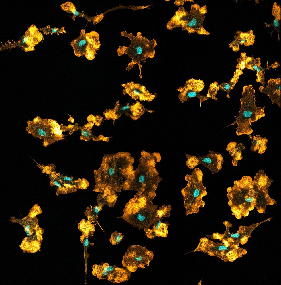 Image décorative. © Mónica Fernández Monreal