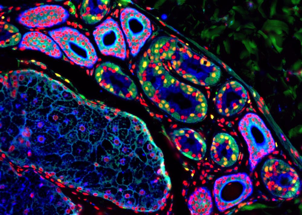 © Katerina Jerabkova-Roda (microscope de la plateforme PICSTRA du CRBS)