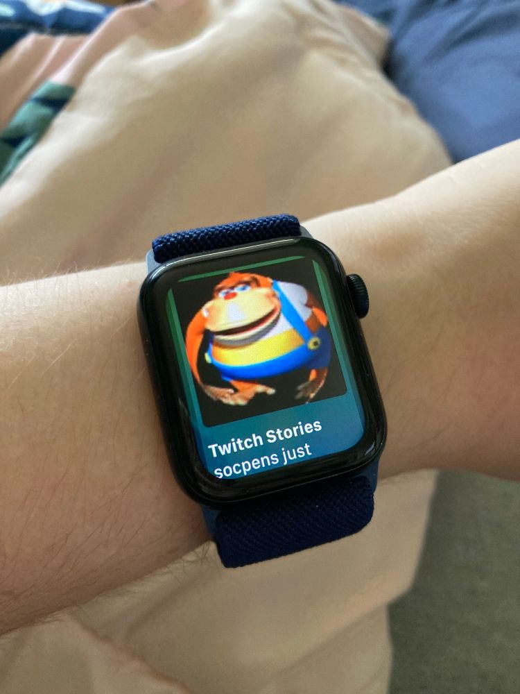 An Apple Watch with a notification showing that socpens just shared a Twitch story. His icon takes up most of the watch face 