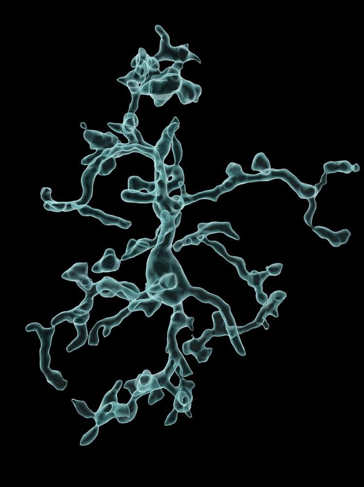 3D reconstruction of the surface of a microglia cell from mouse brain.