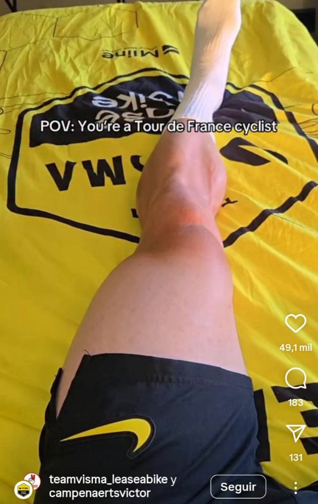 Campy's left quad, relaxed but pretty bulky 