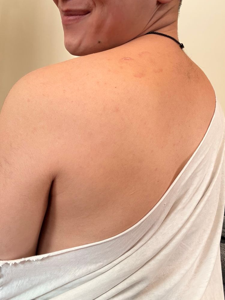 mal is looking over their shoulder and smiling, wearing a loose white shirt and their collar. there are two bite marks on their shoulder, very close together. 