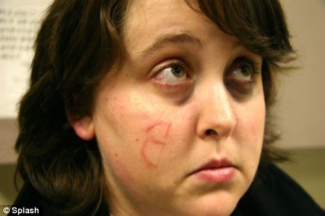 White lady with a backwards B scratched into her cheek for a bit of racism