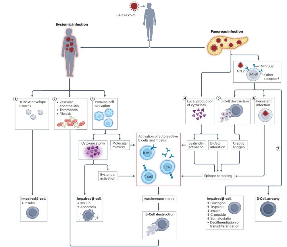 Figure showing SARS-CoV-2 infection and pathogenesis of type 1 diabetes mellitus.