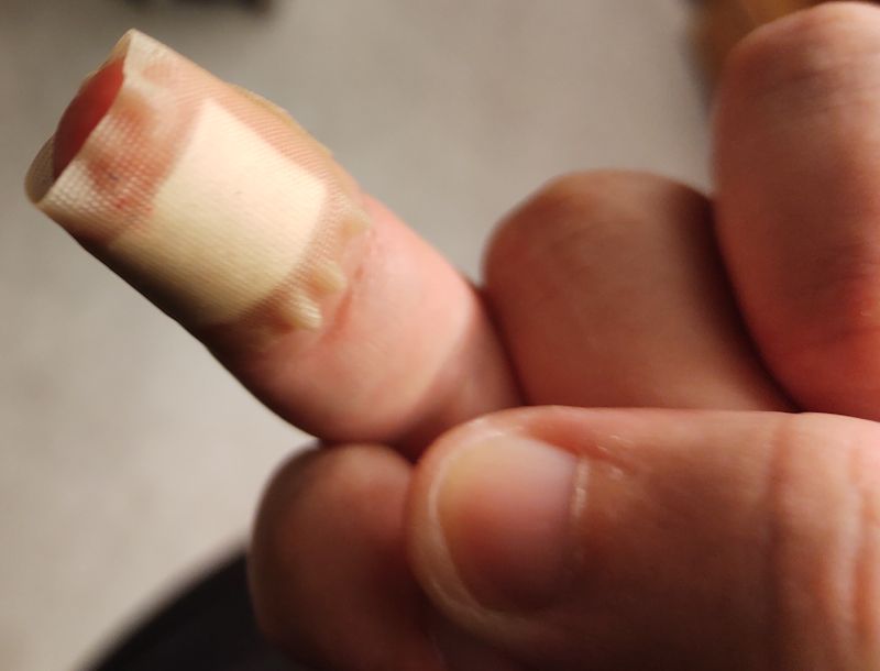 Bild på mitt omplåstrade ringfinger med övriga fingrar som tröstande sällskap.