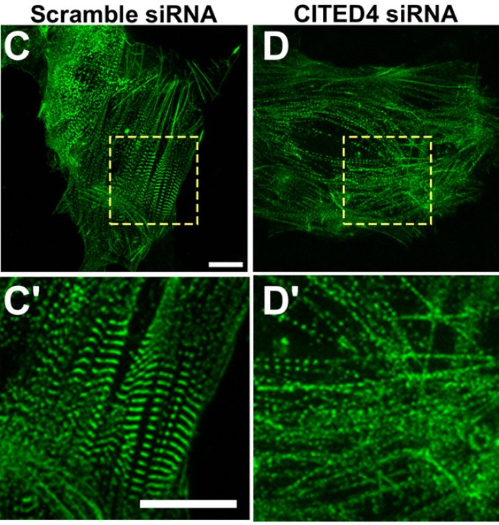 Four panels from a research image showing green cardiomyocytes at different magnifications.