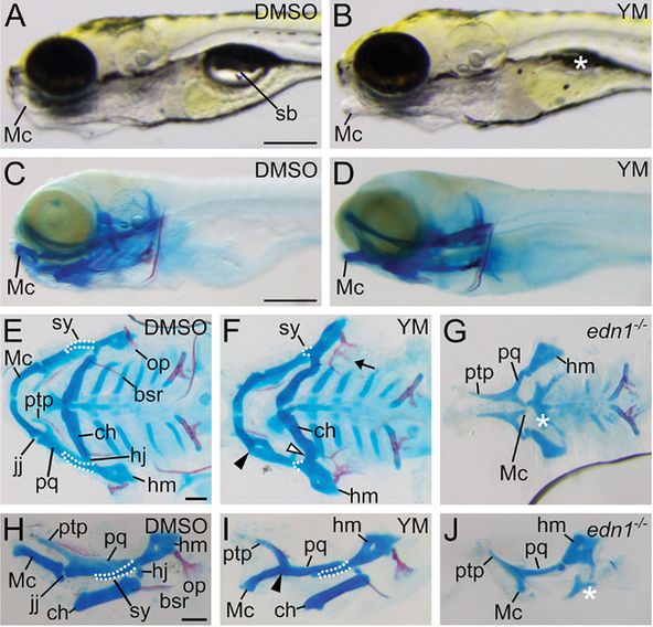 Figure 2 YM causes defects to a subset of Edn1/Ednra-dependent lower jaw skeletal elements. (A-D) Lateral views of 6 dpf embryos treated with DMSO (A,C) or YM (B,D), shown in gross (A,B) or whole-mount skeletal preparations of larvae (C,D). The asterisk in B indicates the absence of an inflated swim bladder (sb). (E-J) Ventral (E-G) or lateral (H-J) views of flat-mounts for the viscerocranium from 6 dpf wild-type larvae treated with DMSO (E,H) or YM (F,I), or an untreated edn1−/− larvae (G,J). In E,F,H,I, white outlines highlight the symplectic cartilage (sy). In F,I, black arrowheads indicate fusion of the jaw joint (jj), white arrowhead indicates fusion of the hyomandibular joint (hj) and the arrow indicates fusion of the opercle (op) and branchiostegal ray (bsr). In G,J, the white asterisk indicates absence of the ceratohyal (ch).