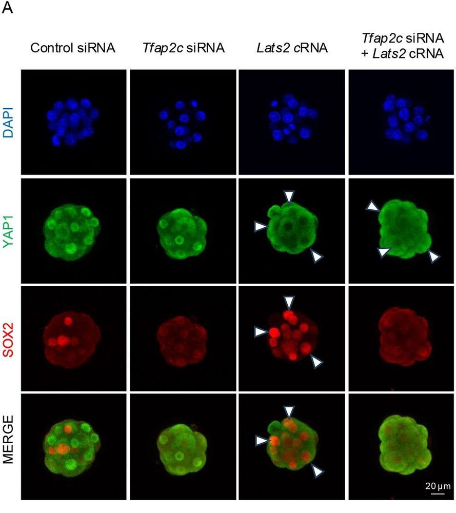 Fig. 6. TFAP2C cooperates with the HIPPO signaling pathway to
regulate Sox2 expression. (A) Confocal IF analysis of YAP1 and SOX2 in
control siRNA-, Tfap2c siRNA- or Lats2 cRNA-injected, and Lats2 cRNA and
Tfap2c siRNA double-injected embryos at the morula stage (E3.25). Two
biological replicates were used, with 10-12 embryos per group. An
equivalent confocal optical section near the equator of each embryo was
used for comparisons. Scale bar: 20 µm. The white arrowheads indicate the
nuclear localization of YAP1 or SOX2.
