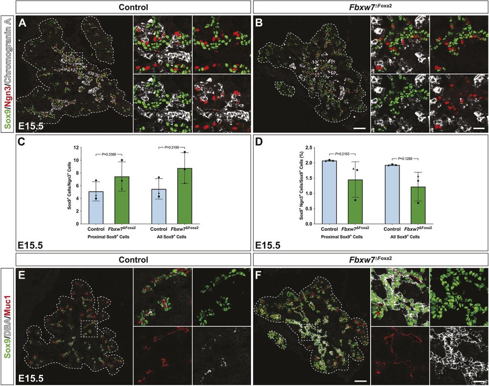 Fig. 2. Fbxw7 deficiency causes ductal dysgenesis in the secondary transition pancreas. (A,B,E,F) Sections of pancreas (splenic and gastric lobes) from E15.5 control (A,E) or Fbxw7ΔFoxa2 (B,F) littermates stained for Sox9, Ngn3 and chromogranin A (A,B: n=5 from three litters) or Sox9, Dolichos biflorus agglutinin (DBA) and Muc1 (E,F: n=3 from two litters) using IF. The epithelial periphery is indicated by dashed lines. Scale bars: 100 μm (main panels); 25 μm (insets). (C,D) Ratio of Sox9+ cells to Ngn3+ cells (C) and Sox9+ Ngn3+ cells as a percentage of Sox9+ cells (D) expressed for proximal (Ptf1a−) Sox9+ cells or for proximal (Ptf1a−) and distal (Ptf1a+) Sox9+ cells (all Sox9+ cells) in splenic and gastric lobes of E15.5 embryos (n=3 from three litters indicated by individual data point symbols; data are mean±s.d.; P-values were calculated using a paired Student’s t-test). 