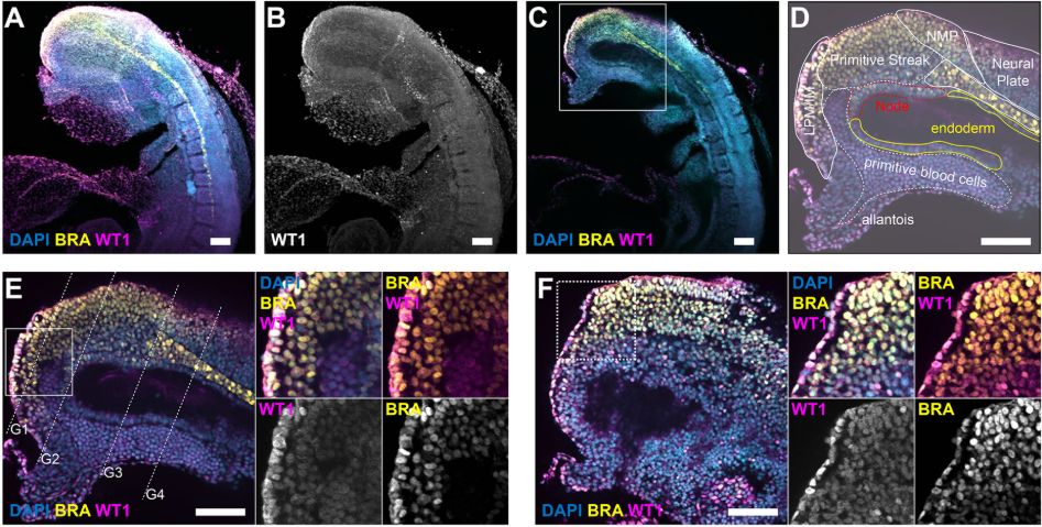 Figure 4 WT1 is expressed in the primitive streak, emerging mesoderm, neuromesodermal progenitor cells and LPM in E8.5 mouse embryos