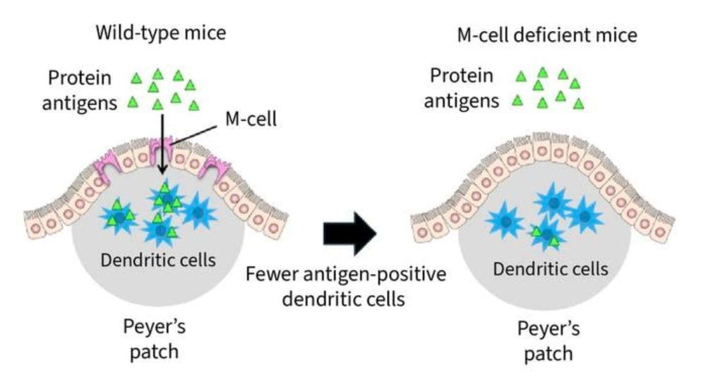 Food Antigens Suppress Tumor Growth in Small Intestine, Study Finds