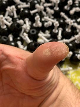 Image of a blister on someones thumb from removing all the the grey bonds from the black atoms for the crystal structure kits
