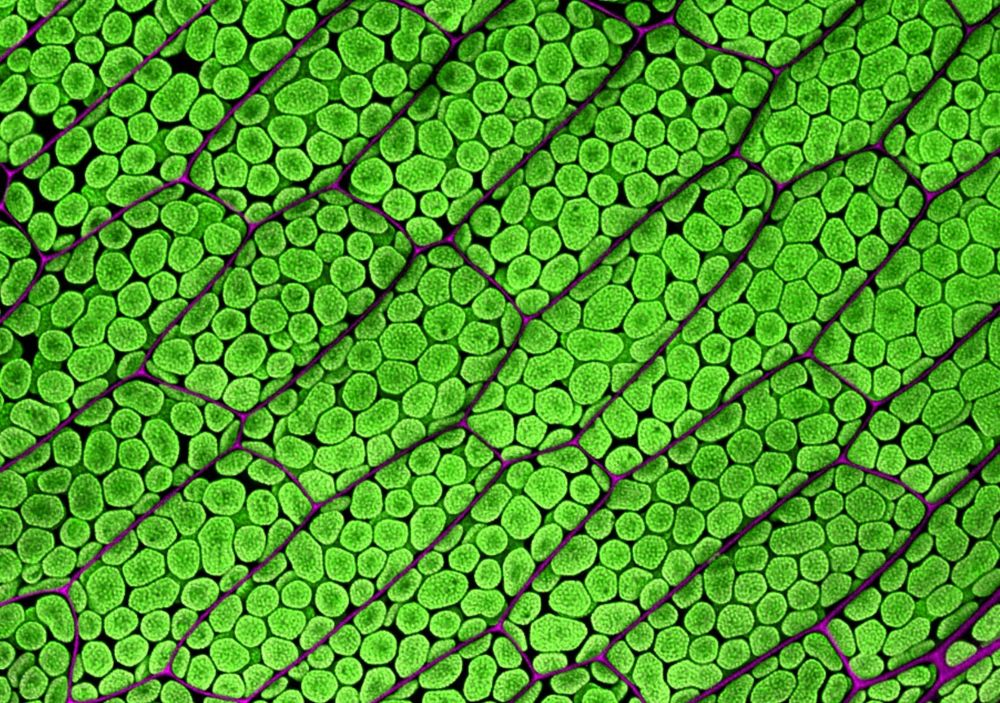 The image shows cells organized like bricks in a wall. Cells are roughly rectangular with magenta outlines (cell walls) and are filled with green, irregular sphericalish chloroplasts. 