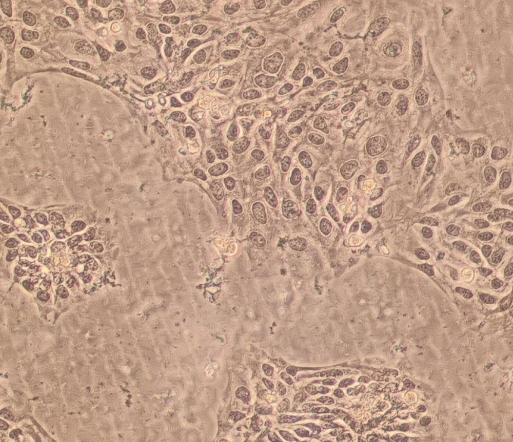 Microscope image of cells in culture, messy and dying