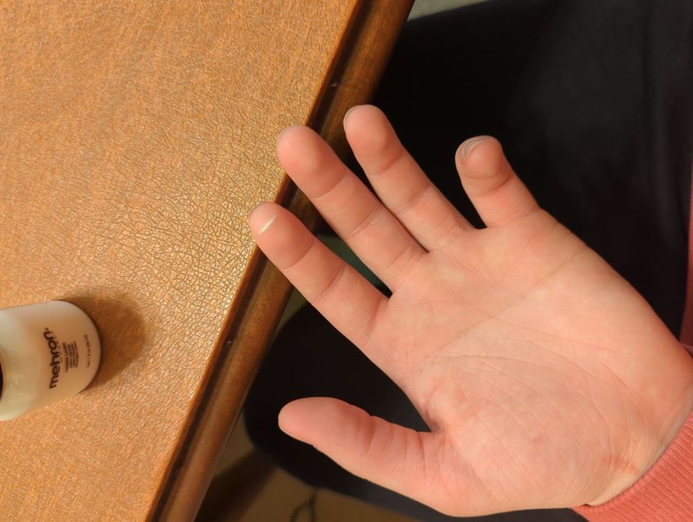 my hand with a thin white line of liquid latex over a 1 cm cut on my index finger where a fingerprint reader would read. also shows the liquid latex bottle in the background and my thighs if you really wanna look at them