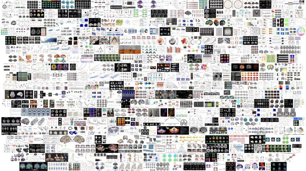 A collage of figures from the 350 papers published in Imaging Neuroscience in 2024.