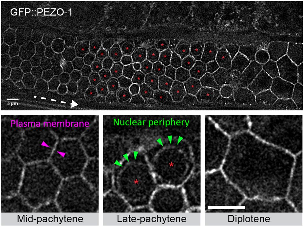 GFP-tagged PEZO-1 protein in C. elegans gonad localizes to both the plasma membrane and the nuclear envelope of oocytes.